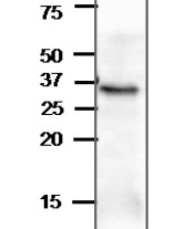 Delta-VPE | Vacuolar-processing enzyme delta-isozyme in the group Antibodies Plant/Algal / Membrane Transport System / Vacuolar membrane at Agrisera AB (Antibodies for research) (AS20 4408)